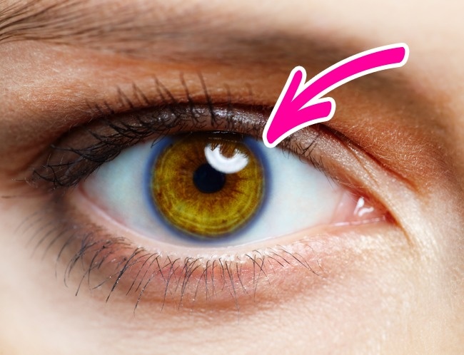 Barevné kruhy kolem duhovek očí