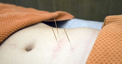 Akupunktura a několik zdravotních důvodů proč ji vyzkoušet