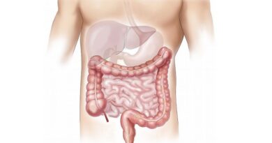 Může vitamín C pomoci předcházet rakovině tlustého střeva?