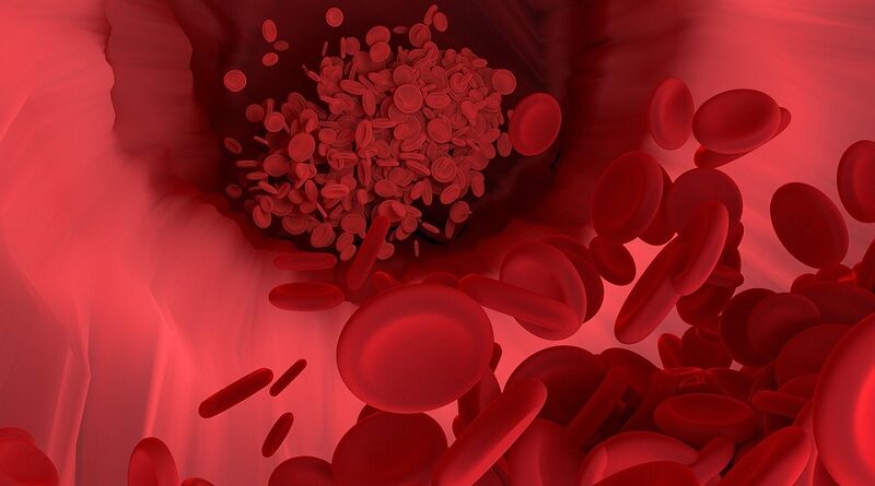 Jak vyčistit krev: Zdravé způsoby čištění krve